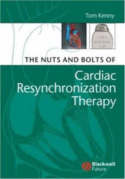 The Nuts and Bolts of Cardiac Resynchronization Therapy