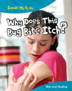 Why does this Bite Itch?
