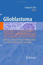 Glioblastoma: