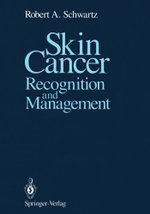 Skin Cancer