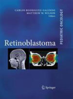Retinoblastoma