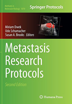 Metastasis Research Protocols