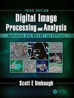 Digital Image Processing and Analysis