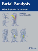 Facial Paralysis