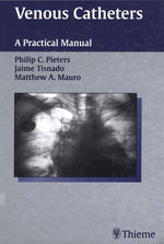 Venous Catheters