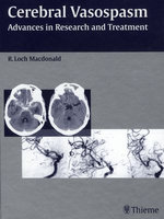 Cerebral Vasospasm
