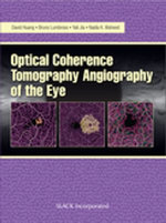 Optical Coherence Tomography Angiography of the Eye