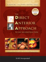 The Direct Anterior Approach to Hip Reconstruction