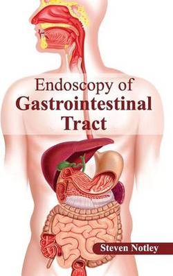 Endoscopy of Gastrointestinal Tract Endoscopy of Gastrointestinal Tract