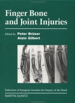 Finger Bone and Joint Injuries