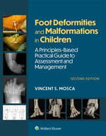 Foot Deformities and Malformations in Children