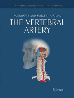 Pathology and surgery around the vertebral artery