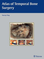 Atlas of Temporal Bone Surgery