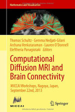 Computational Diffusion MRI and Brain Connectivity