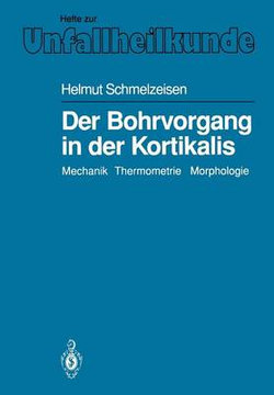 Der Bohrvorgang in der Kortikalis