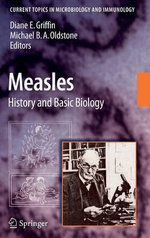 Measles