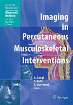 Imaging in Percutaneous Musculoskeletal Interventions