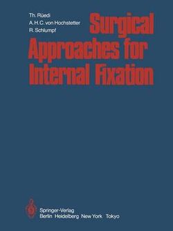 Surgical Approaches for Internal Fixation