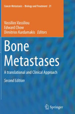 Bone Metastases